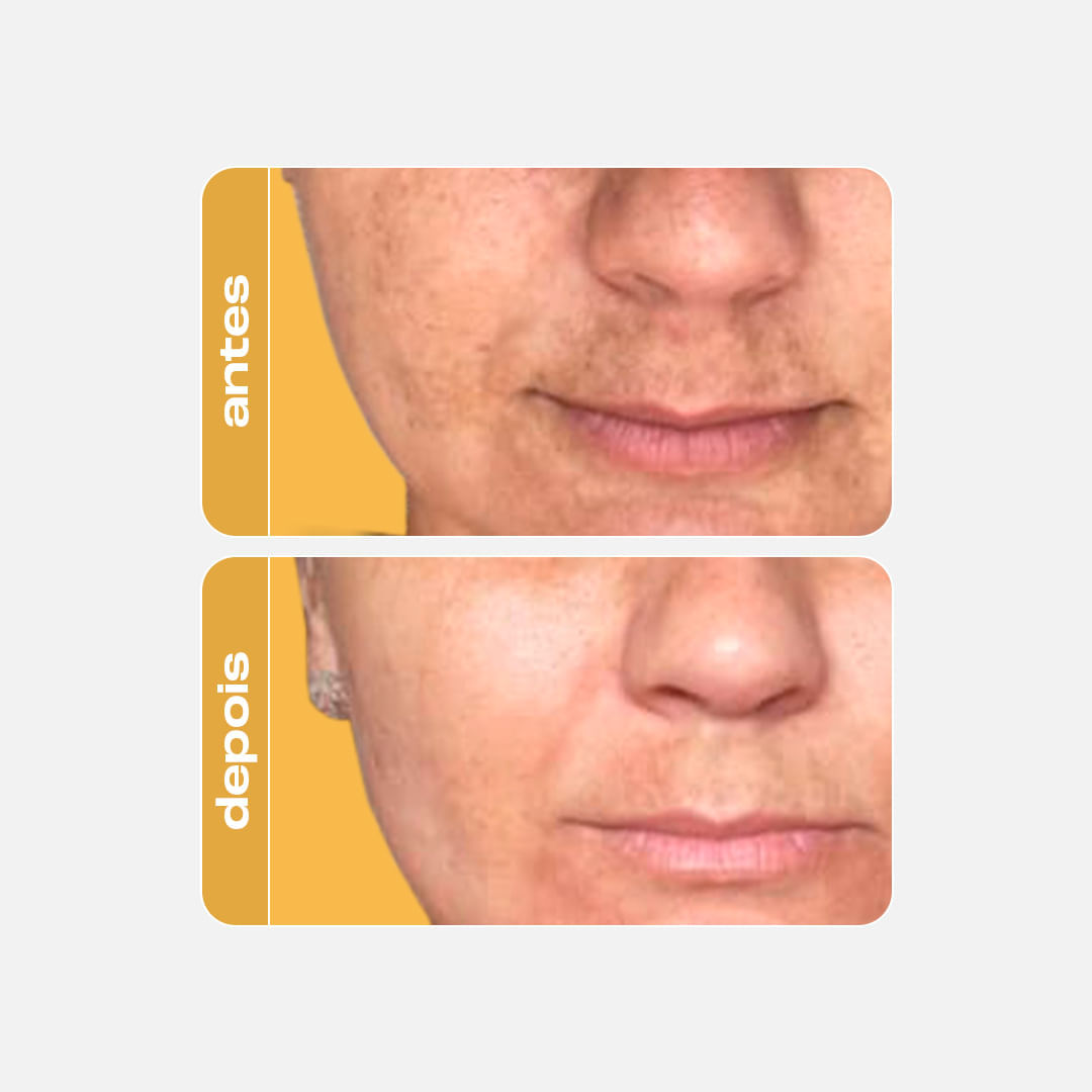 Sérum Antioxidante Clareador - Vitamina C Gold
